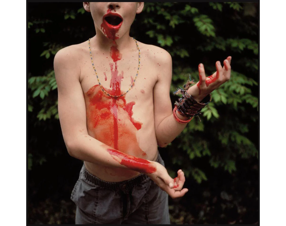 © Sally Mann. Bloody Nose, 1991. Silver dye-bleach print. Private collection
