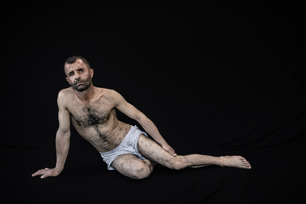 Hawar, Open Wounds. © Younes Mohammad