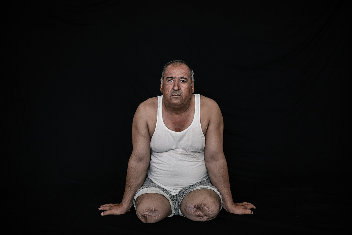 Brahim. Open Wounds. © Younes Mohammad