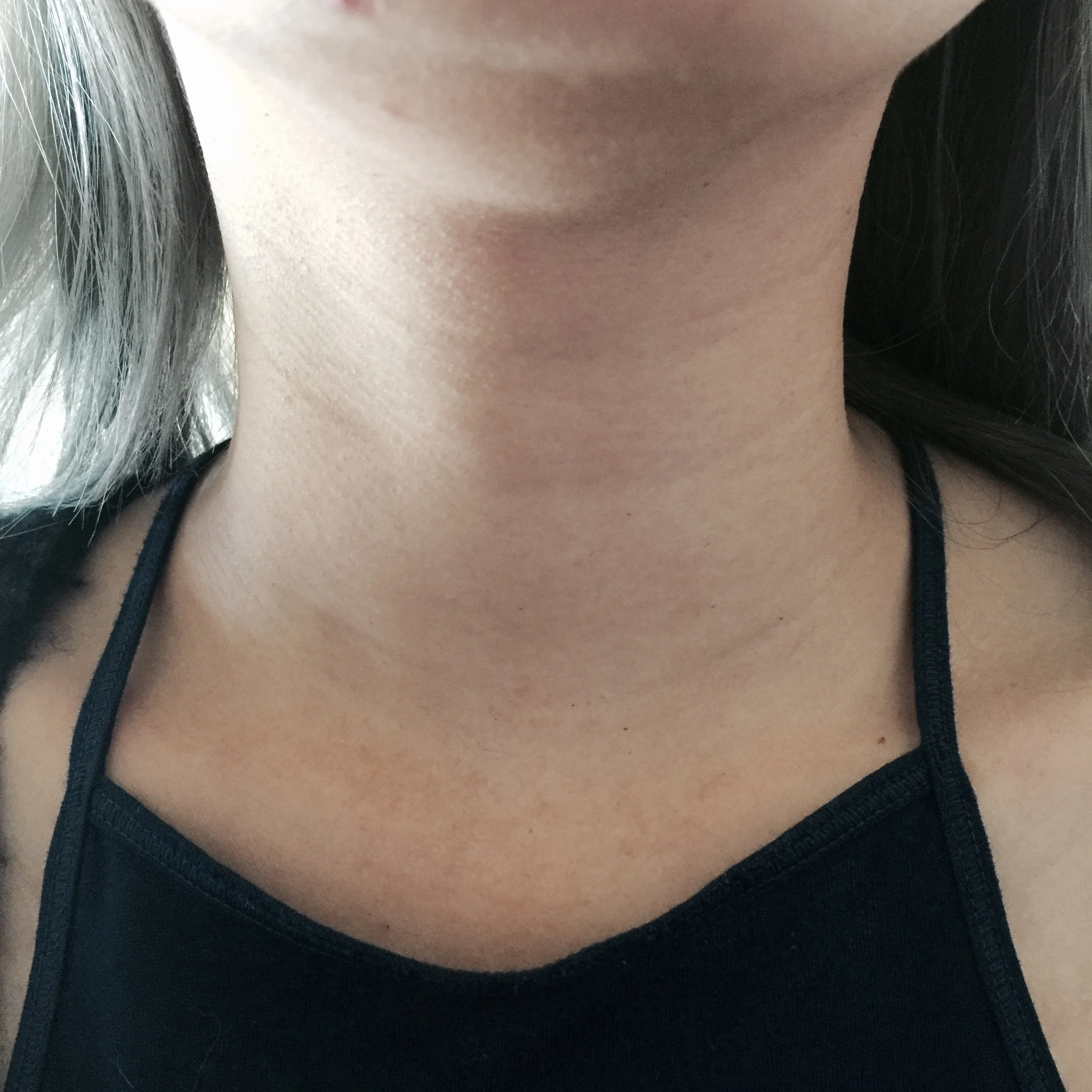 AFTER THE PATCH. My neck is slightly brighter, wrinkles aren't as defined as before. 