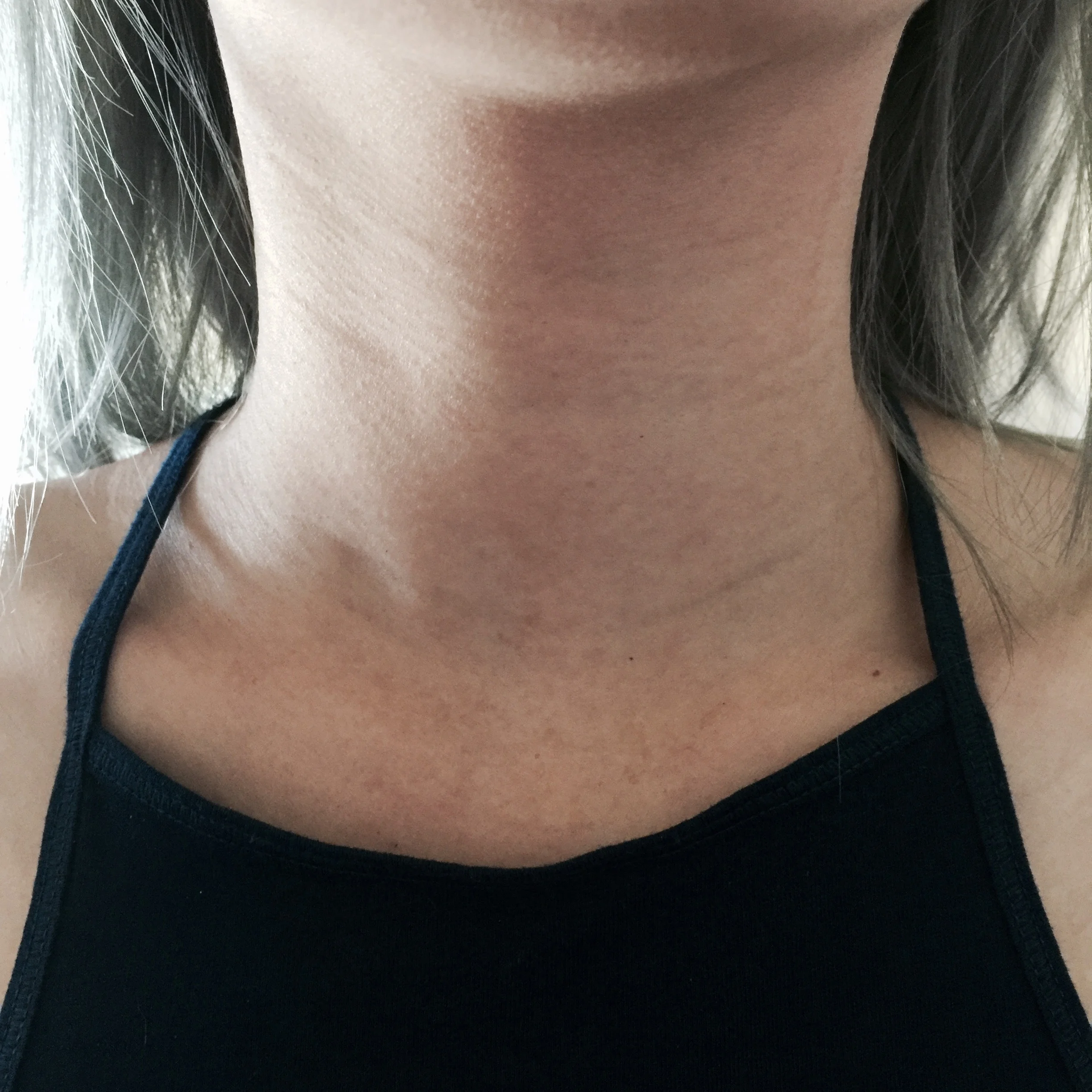 BEFORE USING THE PATCH. You can see that I have a wrinkly neck. 
