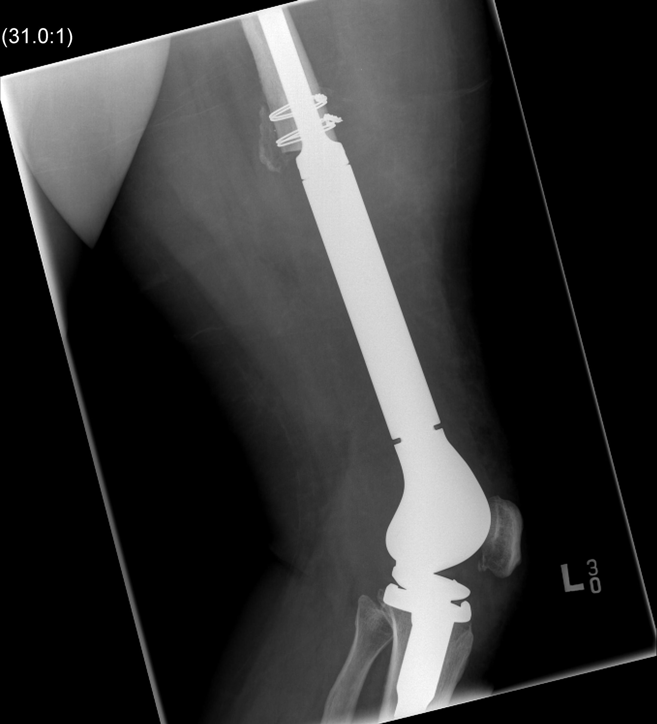 Click on picture for more (gross warning) info at the Bone School