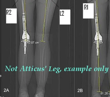 xray example1.jpg