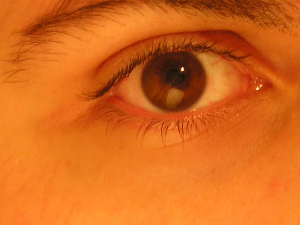 eye.jpg