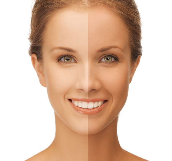 45974370 - beautiful woman with half face tanned