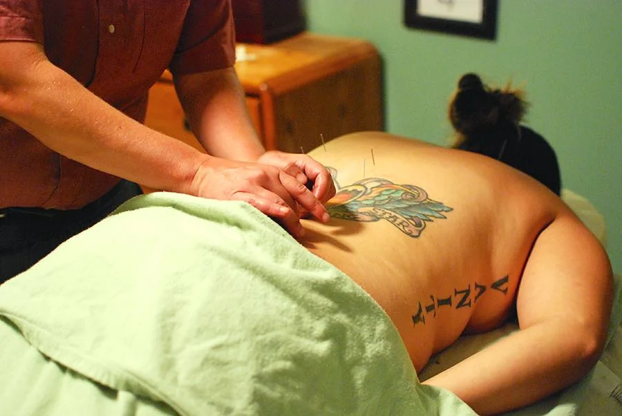 denver-acupuncture-treatment.jpg