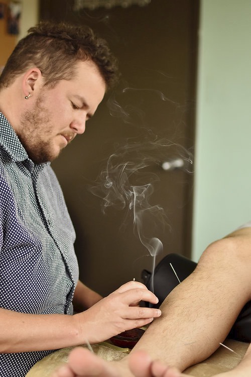 Moxibustion on patient