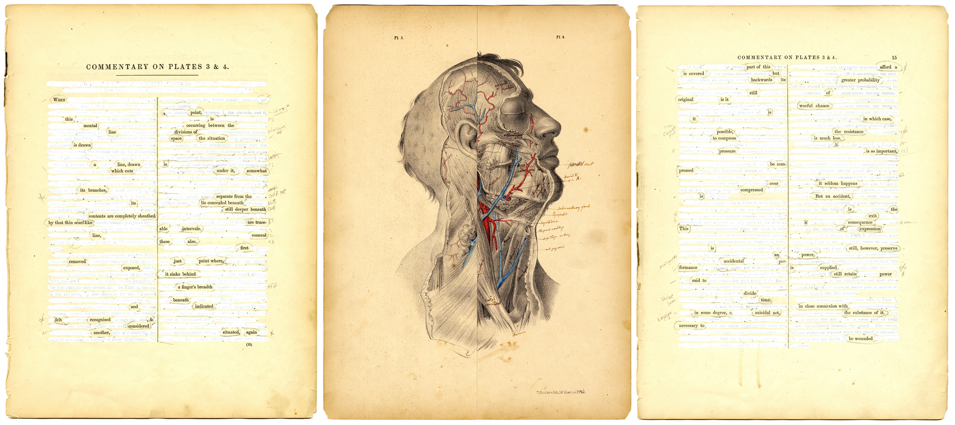 Surgical Pages, Plates 3 and 4