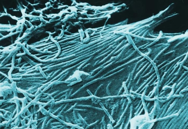 Scanning electron microscopic image of Ebola virions. From Public Library of Science, published in October 2005. Posted on Wikimedia under Creative Commons Attribution 3.0.
Normal
0
false
false
false
EN-US
X-NONE
X-NONE
/* Style Definitions */
table.MsoNormalTable
{mso-style-name:"Table Normal";
mso-tstyle-rowband-size:0;
mso-tstyle-colband-size:0;
mso-style-noshow:yes;
mso-style-priority:99;
mso-style-parent:"";
mso-padding-alt:0in 5.4pt 0in 5.4pt;
mso-para-margin-top:0in;
mso-para-margin-right:-1.0in;
mso-para-margin-bottom:10.0pt;
mso-para-margin-left:0in;
line-height:115%;
mso-pagination:widow-orphan;
font-size:17.0pt;
font-family:"Georgia","serif";}
Normal
0
false
false
false
EN-US
X-NONE
X-NONE
/* Style Definitions */
table.MsoNormalTable
{mso-style-name:"Table Normal";
mso-tstyle-rowband-size:0;
mso-tstyle-colband-size:0;
mso-style-noshow:yes;
mso-style-priority:99;
mso-style-parent:"";
mso-padding-alt:0in 5.4pt 0in 5.4pt;
mso-para-margin-top:0in;
mso-para-margin-right:-1.0in;
mso-para-margin-bottom:10.0pt;
mso-para-margin-left:0in;
line-height:115%;
mso-pagination:widow-orphan;
font-size:17.0pt;
font-family:"Georgia","serif";}
