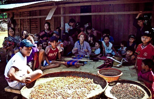 Woman with thyroid goiter, Bolaven Plateau