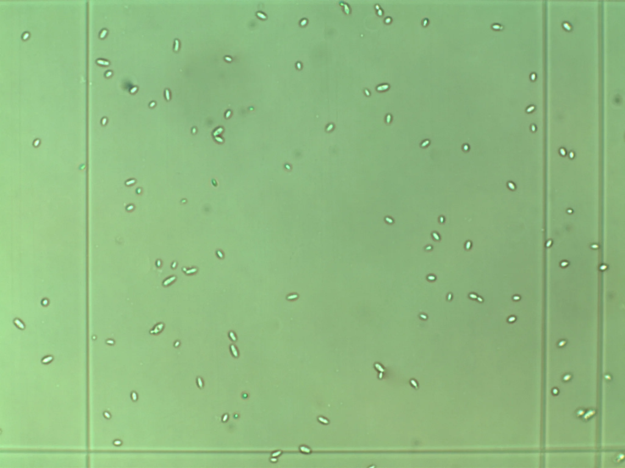 these funny looking beasties - Orval derived Brettanomyces Bruxellensis yeast isolated and cultured courtesy of Nick Malmquist in a professional lab (during his free time) - thanks Nick!
