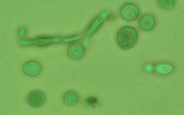 Brettanomyces strain used for primary fermentation. Notice the Brett polymorphism (cells are all different shapes)