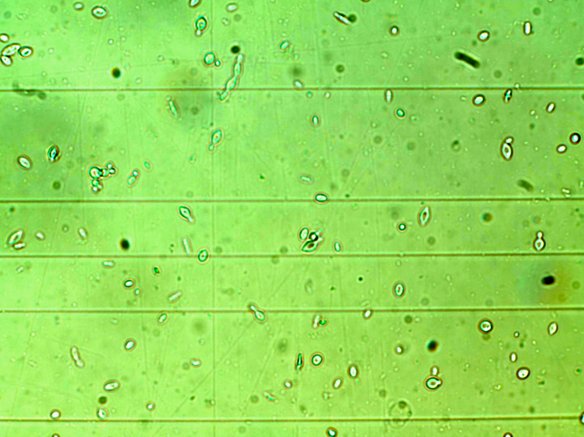 Some exotic looking microbes from the (unwashed / unpasteurised) Colapuy apple juice including Kloekera yeast and perhaps some non yeast entities?