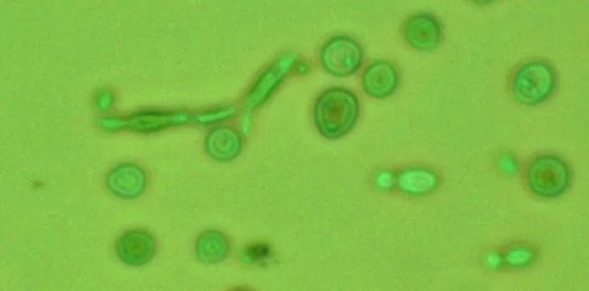 Souche de Brettanomyces utilisée pour le brassin - a noter le phénomène de 'polymorphism' - les cellules sont toutes de formes differentes.