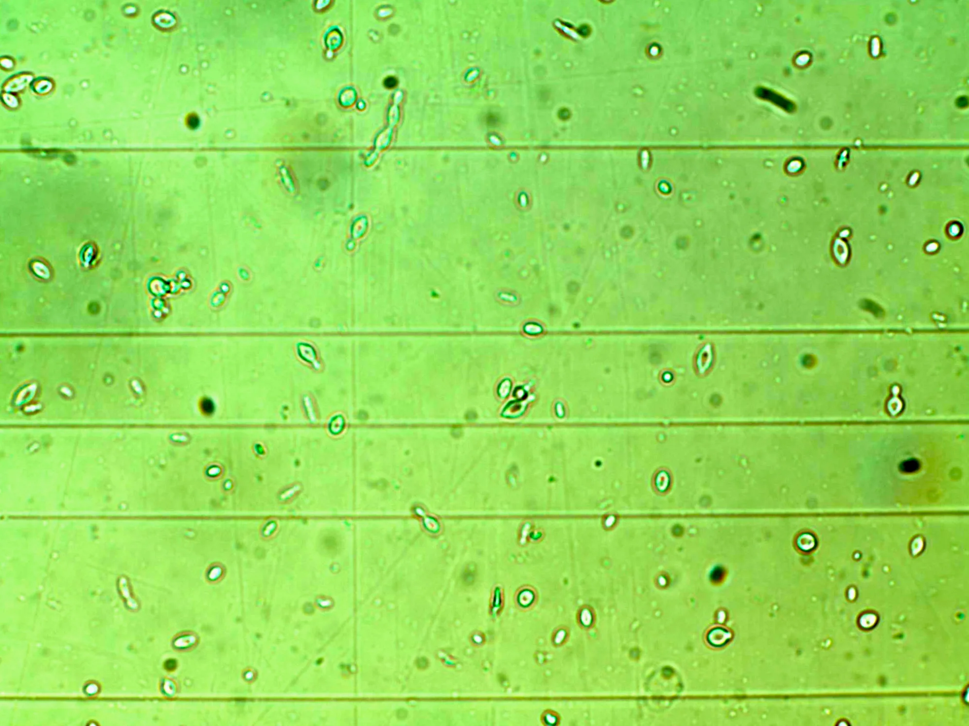 Des microbes exotiques provenant de jus de pommes Colapuy (non lavé, non pasteurisé) y compris des levures Kloekera et peut-etre des élements non levuriformes?