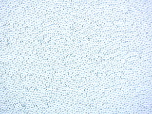 The first is thin and opaque. It has a dimpled pattern and while transmits light, it is not enough to really see through.