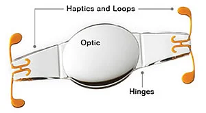This is the Crystalens. It was hoped that it would allow clear vision at all distances are mimic your natural lens. It didn't quite work out.