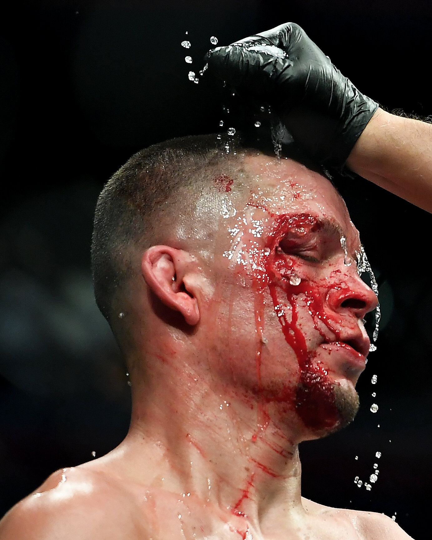  Nate Diaz gets treatment during his fight against Jorge Masvidal during UFC 244 at Madison Square Garden in New York City on November 2, 2019. 