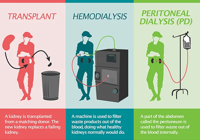 The transplant picture lies. The failing kidney stays in the body. Therefore I would have 3 totally kidneys. The reason is because taking the affected kidneys out could create an infection. Which recipients of a donor kidney have to take immune suppressants so the new kidney doesn't reject.