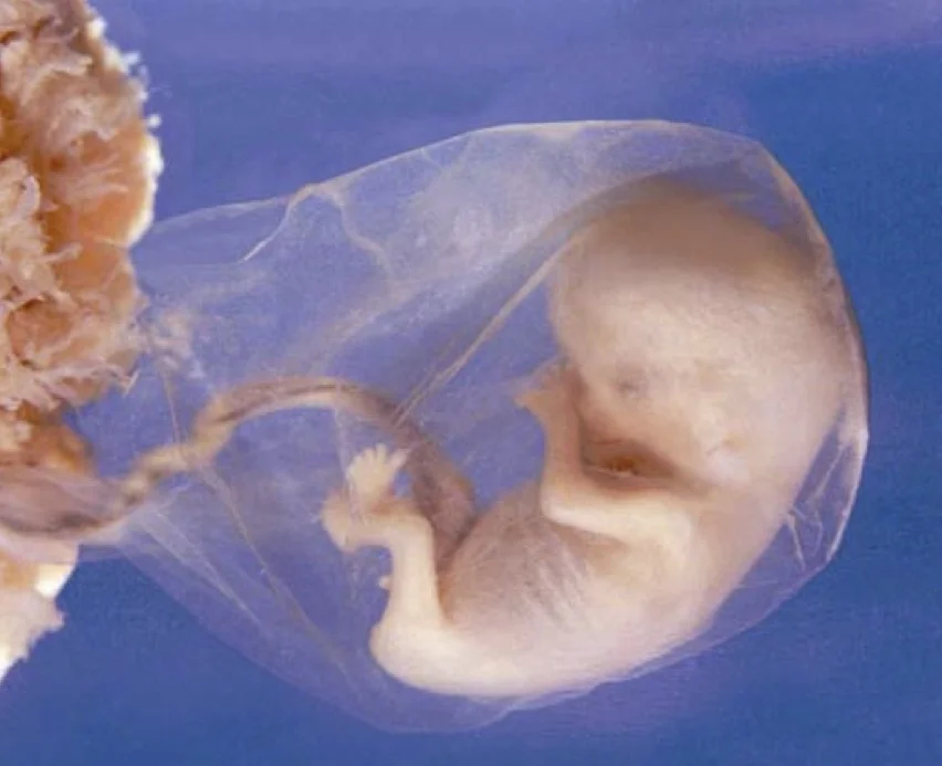 image abortion .jpg