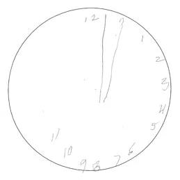 Visual-Neglect-Clock-Dial.jpg
