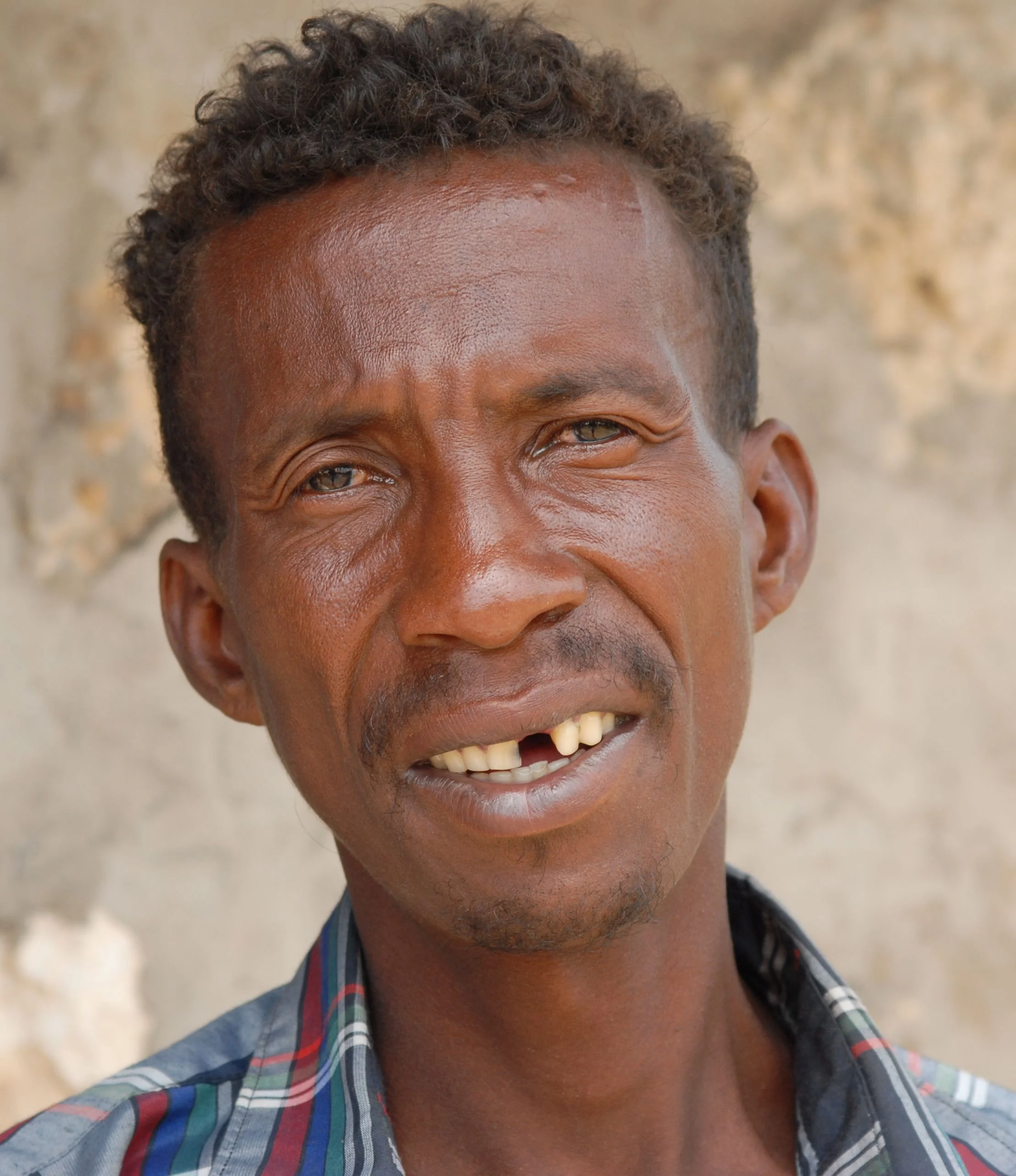 Tooth Missing Man
