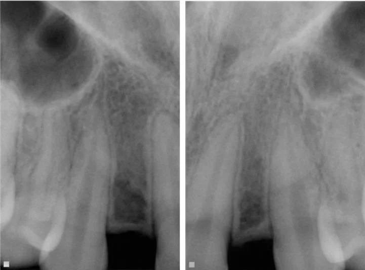 xraybefore.jpg