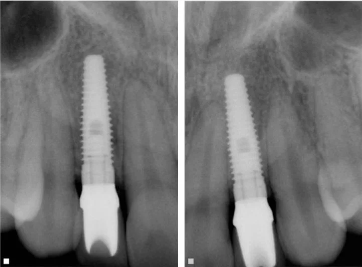 xrayAfter.jpg