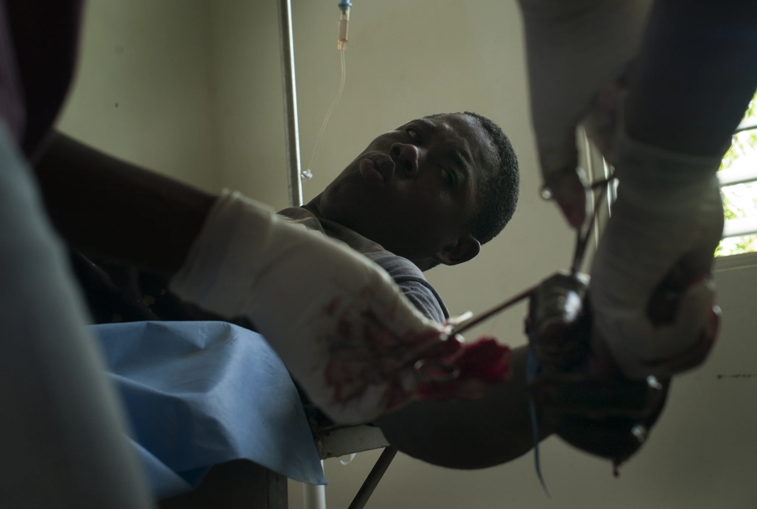  Fixing a machete wound,  Paraiso, Dominican Republic.  