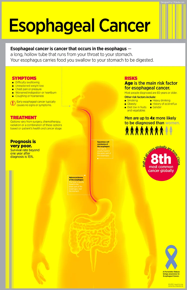 EsophagealCancer_INFOGRAPHICweb.jpg