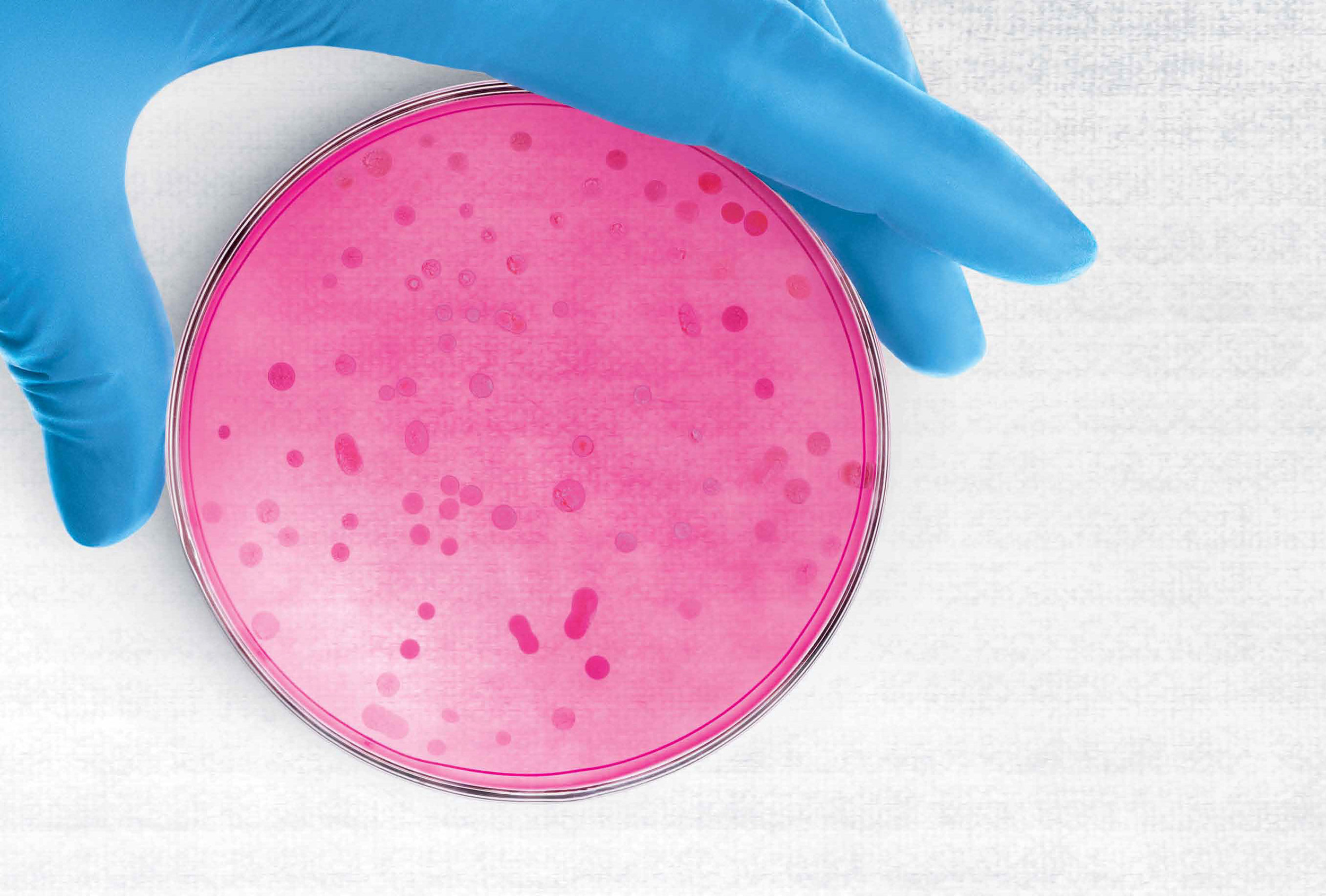 QNT petri dish.jpg