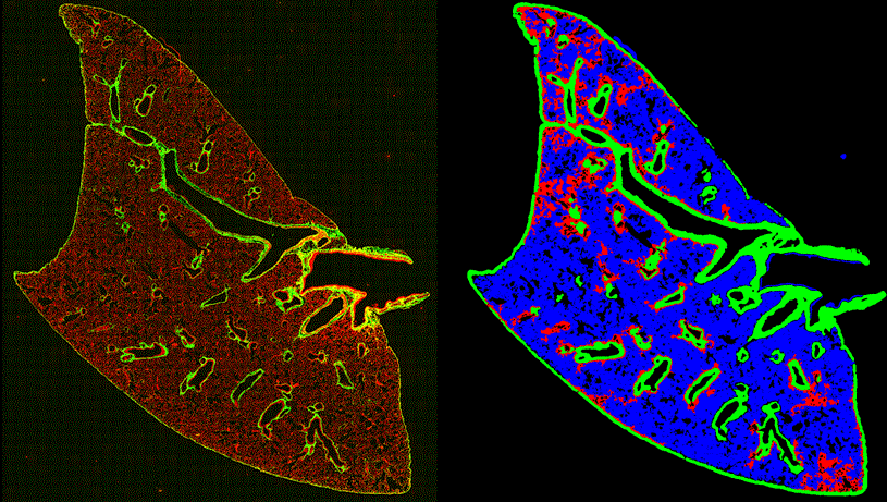  IPF BLEOMYCIN MOUSE LUNG MODEL