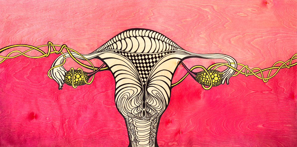 Endometriosis.jpg