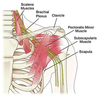 Arm-Pain.jpg