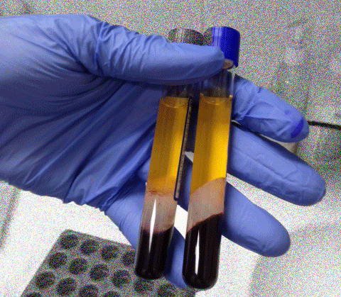 Prepared-PRP-in-Ampoules.gif