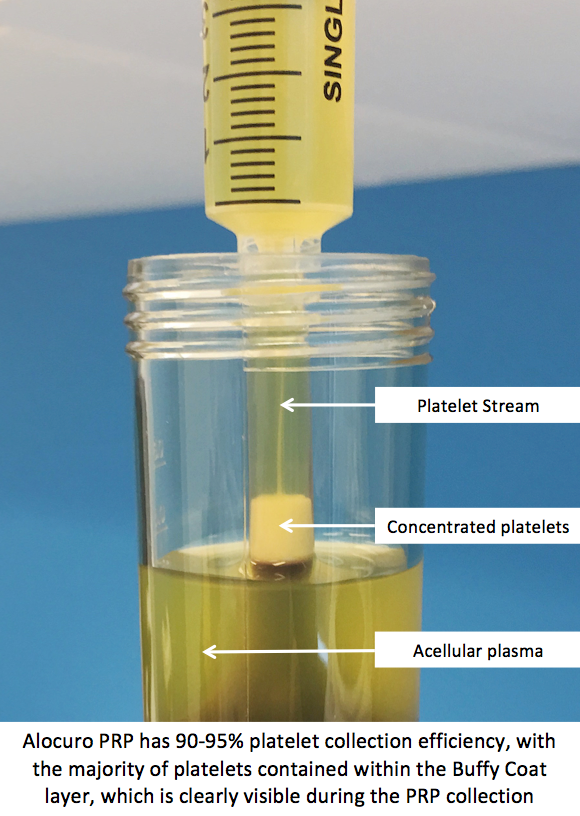 PRP-Removed-From-Ampoule.gif