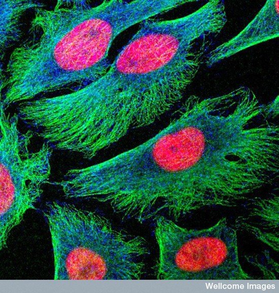 Human HeLa cells in culture. The cytoskeleton is in green. Image credit: Matthew Daniels. Source: Wellcome Images.