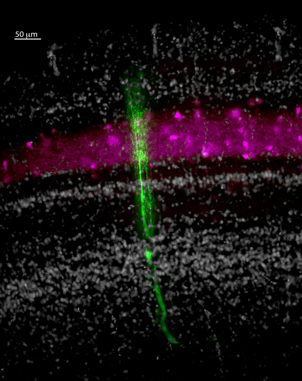 A neuron that released acetylcholine (green) targets neurons that release GABA (purple). Photo credit: C. Alex Goddard.