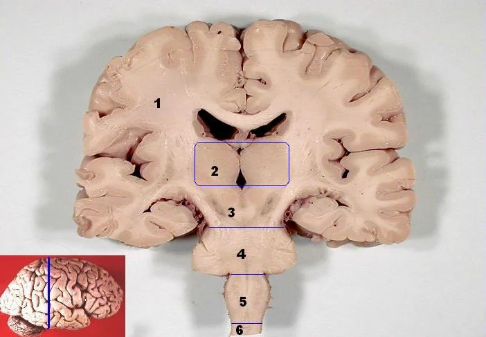 Human brain frontal (coronal) section. Can you spot the substantia nigra? Hint: it's 2 (bilateral) regions that are substantially darker than the tissue that surrounds them.