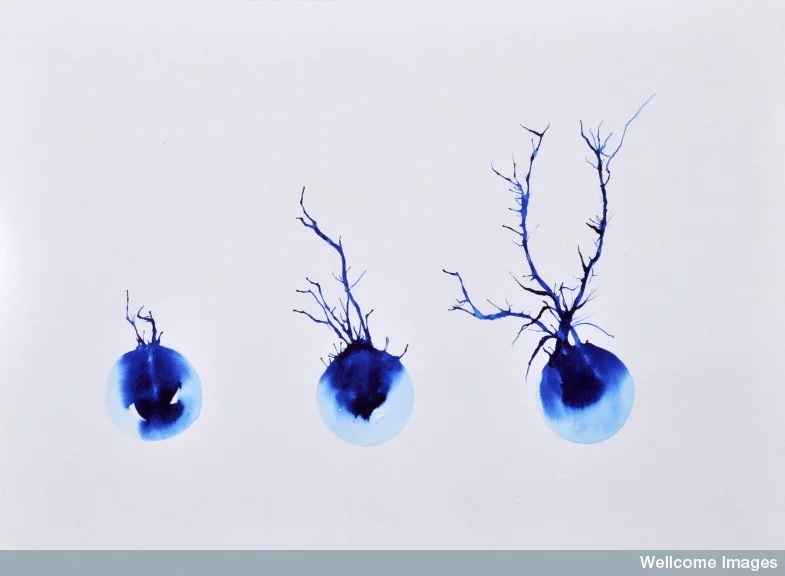 What if ... your brain had too many neurons?