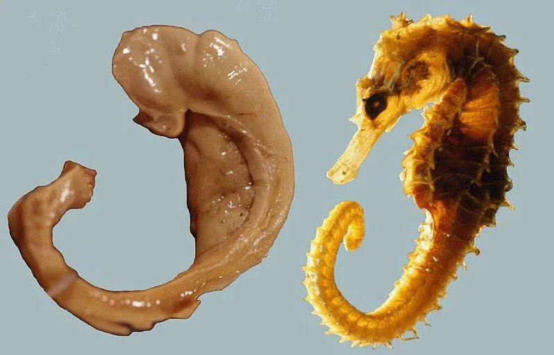 Left: Human Hippocampus. Right: Seahorse. Both: Humanity's boundless ability for thinking one thing looks like another thing. Prepared by Laszlo Seress, 1980. Source: Wikipedia Commons