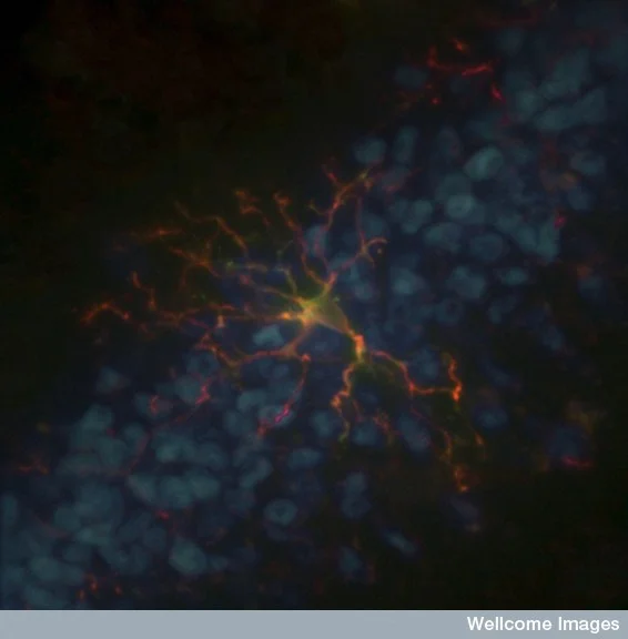 A microglia cell, in the mouse hippocampus. Credit: Simon Beggs, Wellcome Images