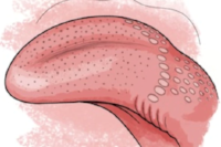 The illustration depicts the “little bumps” located on our tongues – called papillae. The front of the tongue contains smaller bumps, while the back contains larger ones. Credit: Resteck, George