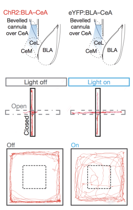 The Anxious Circuit