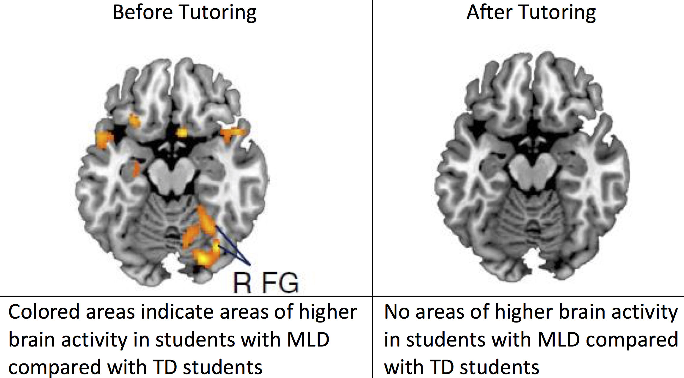 Mind the Test: Brain-Based Tutoring