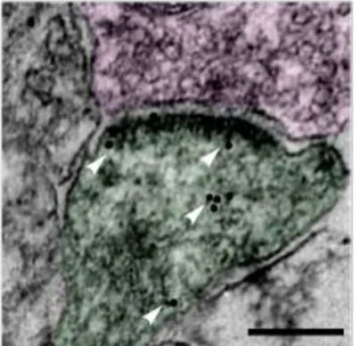 Brain cancer can talk, and talking can help it grow