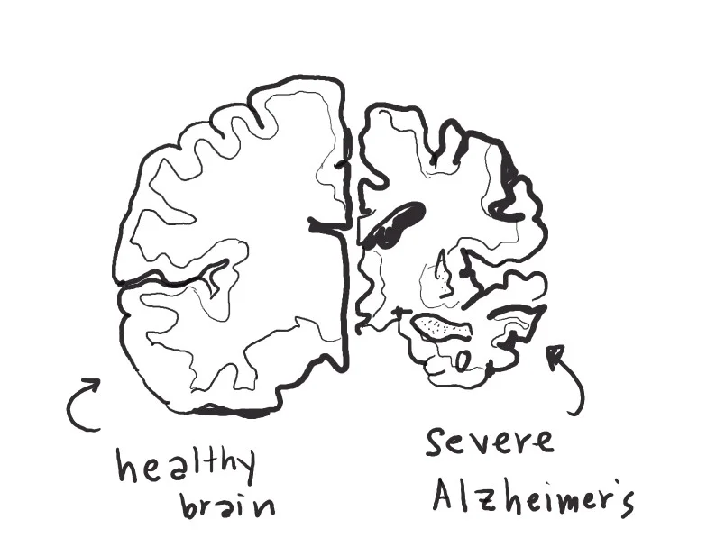 I have volunteered for over a year as a pet therapist inside locked memory care wards. All of my patients lived with late stages of dementia and Alzheimer’s. It has been the most intense and rewarding work I’ve ever done. I’ve written an essay about it, but haven’t found a home for it yet. Guess, I should still keep sending it out….