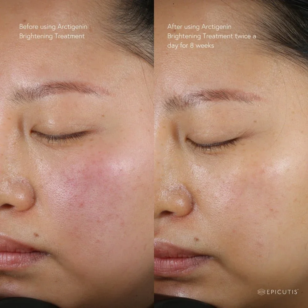 epicutis-arctigenin-brightening-treatment-8517691.jpg.webp