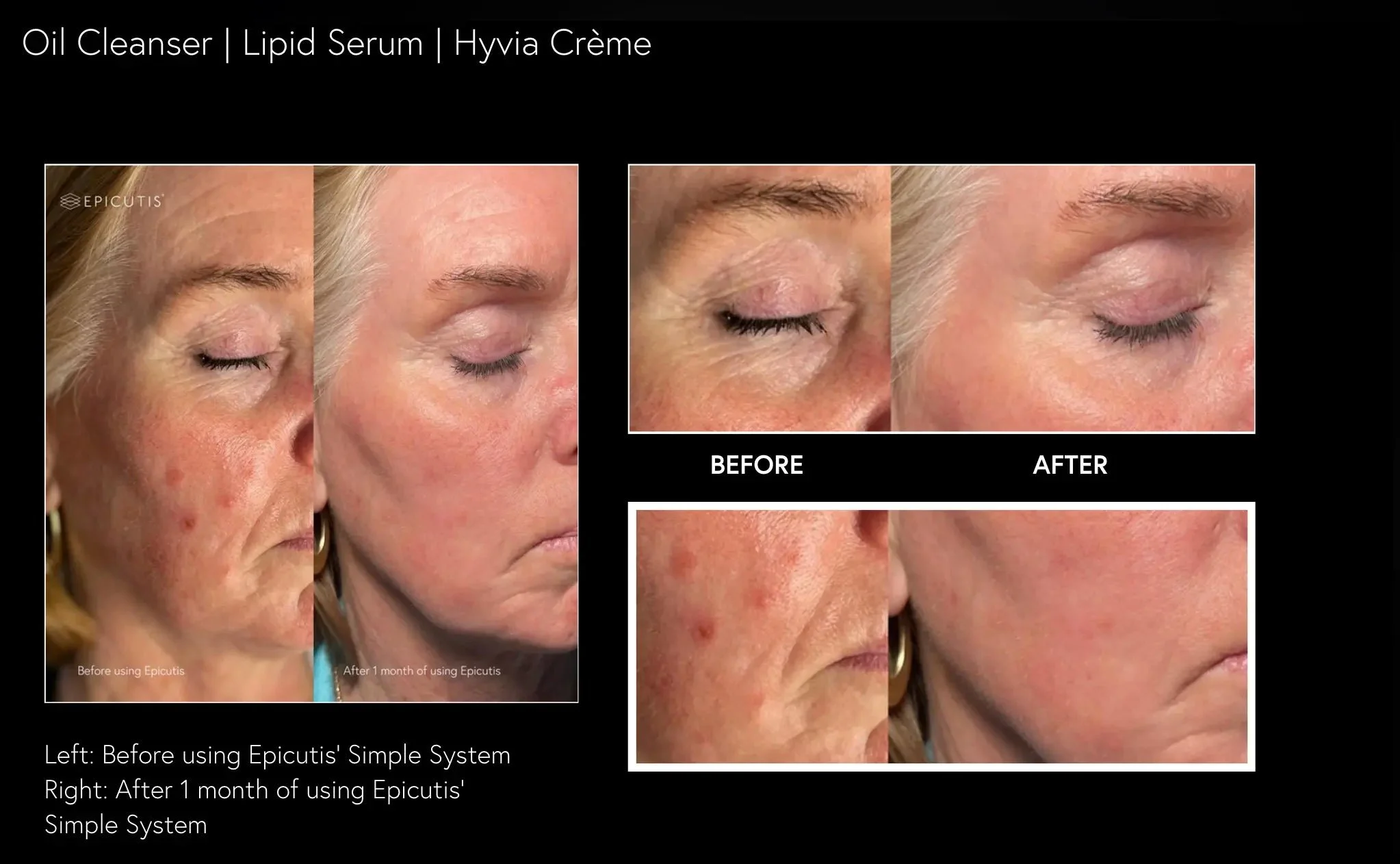 Epicutis_Before_and_After_Results_Canada.webp.jpeg
