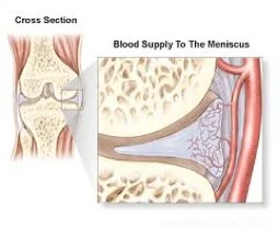 The Peripheral Third of the Medial Meniscus has a Blood Supply Allowing successful repair. 